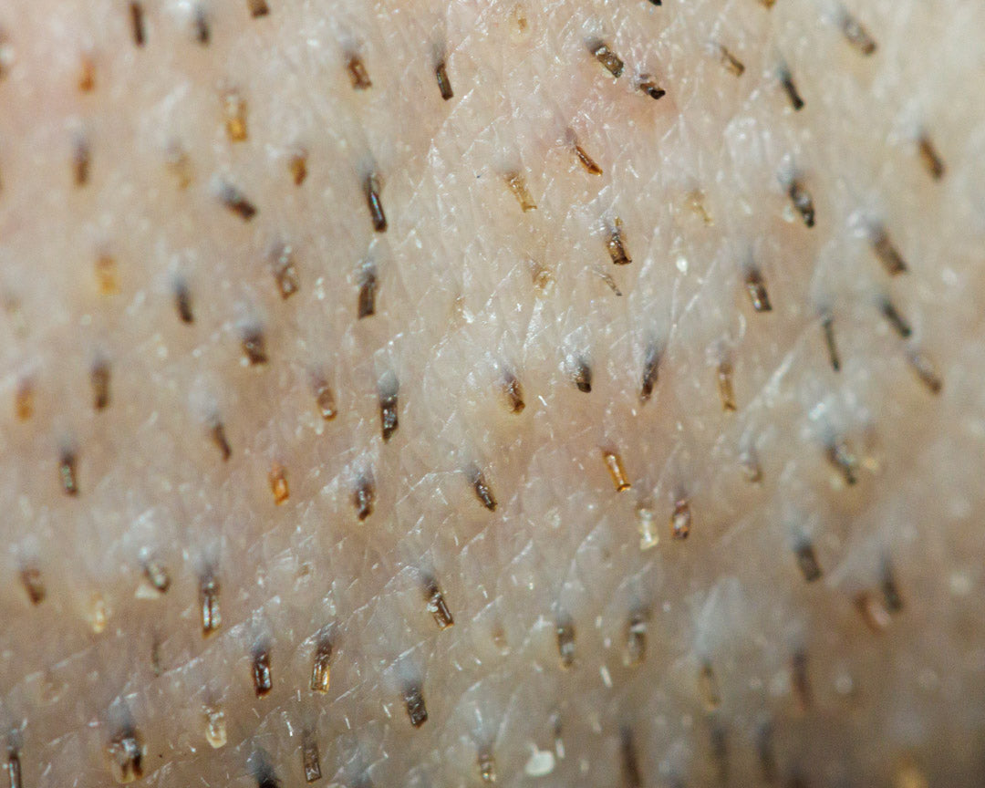 A macro shot of facial hair follicles growing out of skin.